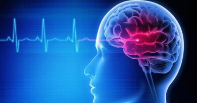 जिम और वर्कआउट के दौरान ब्रेन स्ट्रोक का बढ़ता खतरा: क्या है मुख्य वजह और क्या सर्जरी है इसका स्थाई समाधान?