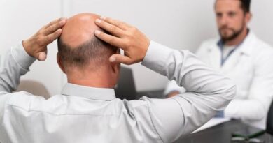 हेयर ट्रांसप्लांट के बाद बाल खिंचने पर क्या वे दोबारा उगेंगे? जानिए सच्चाई और जरूरी उपाय