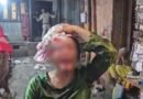 मथुरा के बांके बिहारी मंदिर के पास बड़ा हादसा: बंदरों की लड़ाई के कारण गिरा मकान का छज्जा, कई श्रद्धालु घायल