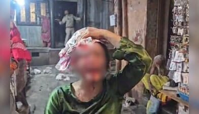 मथुरा के बांके बिहारी मंदिर के पास बड़ा हादसा: बंदरों की लड़ाई के कारण गिरा मकान का छज्जा, कई श्रद्धालु घायल