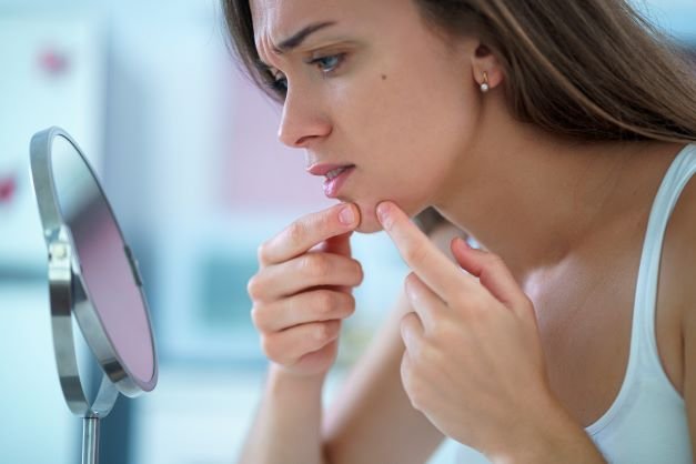 क्या मुंहासों को फोड़ना चाहिए? जानें नुकसान